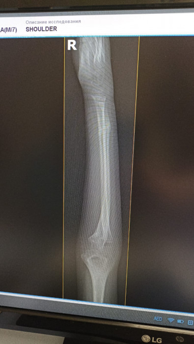 Методики и поющие чаши Healingbowl® в центре реабилитации Кораблёва С.Г., Москва. - изображение 2