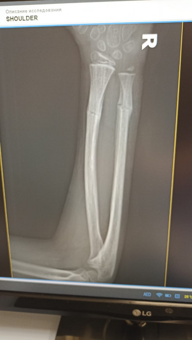 Методики и поющие чаши Healingbowl® в центре реабилитации Кораблёва С.Г., Москва. - изображение 5