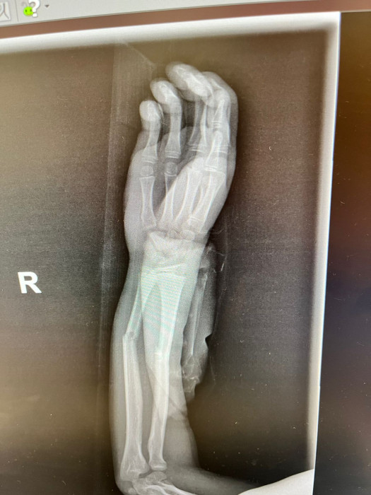 Методики и поющие чаши Healingbowl® в центре реабилитации Кораблёва С.Г., Москва. - изображение 6