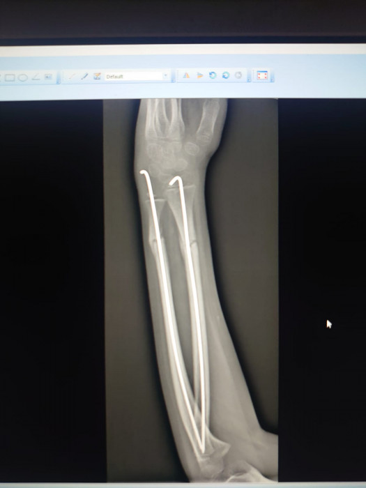 Методики и поющие чаши Healingbowl® в центре реабилитации Кораблёва С.Г., Москва. - изображение 8