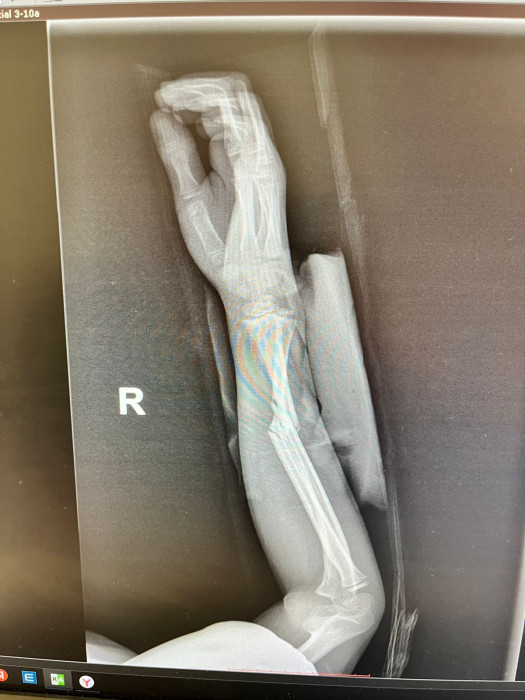 Методики и поющие чаши Healingbowl® в центре реабилитации Кораблёва С.Г., Москва. - изображение 10